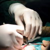 a surgical operation