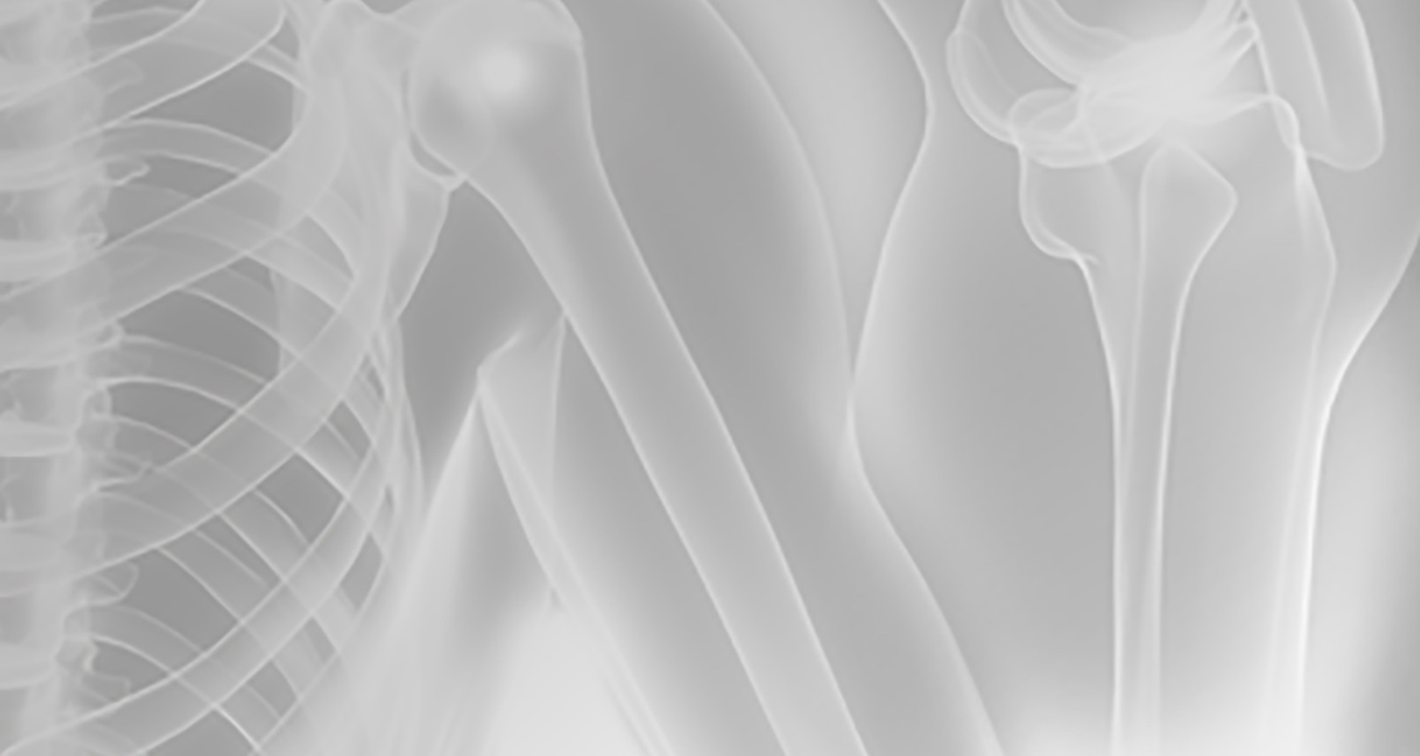 X-ray of torso and shoulder